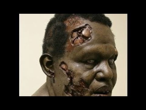 Virus Ebola System Fight Against Ebola Documentary