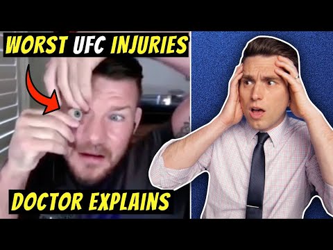 Worst UFC Injuries EVER! Doctor Explains SHOCKING Michael Bisping Eye Injury Story
