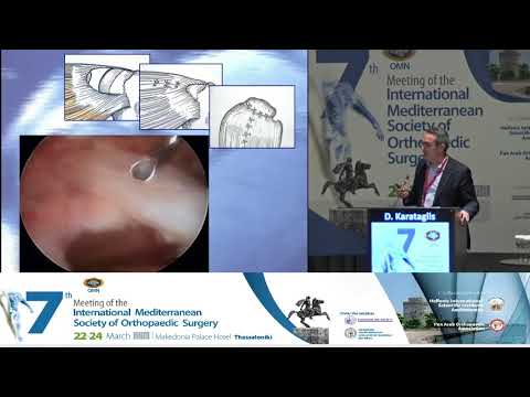 D Karataglis - Present and future in arthroscopic rotator cuff repair