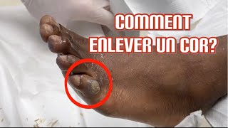 COR AU PIED! Michaël Cohen Pédicure Podologue à Créteil 94