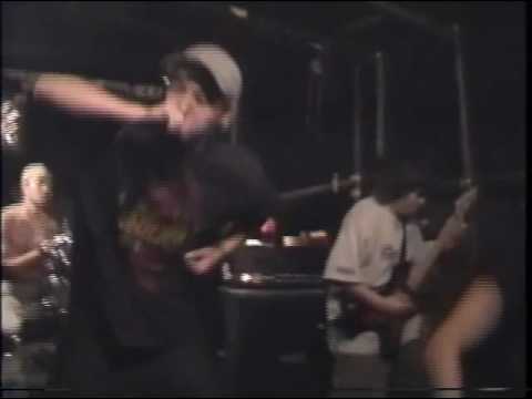 Glossectomy (Japan) Live part1