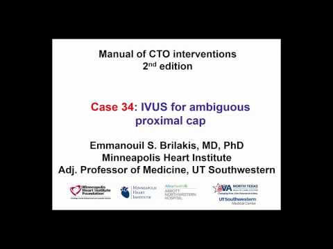 Case 34: Manual of CTO Interventions - IVUS for proximal cap ambiguity