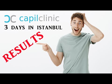 Hair Transplant in Istanbul ⭐ Turkey 🔥 Results 🔥...