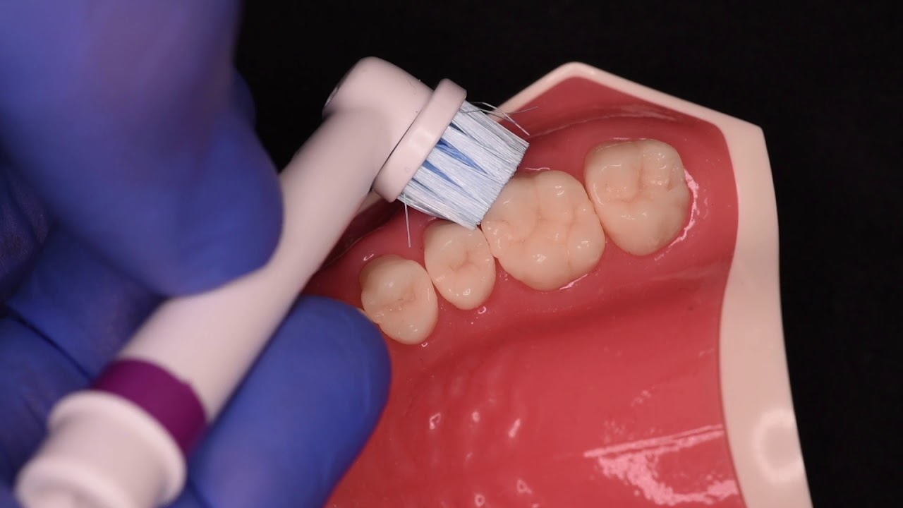 Video: Electric toothbrushing — correct technique