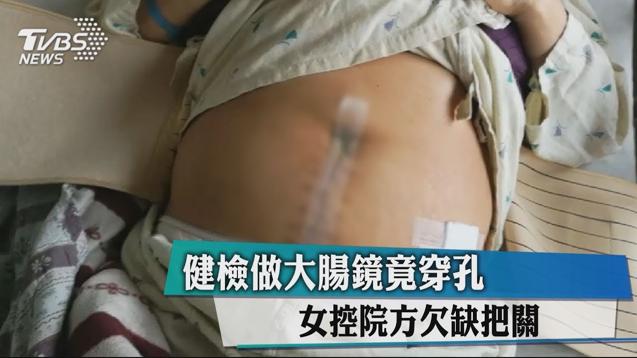 健檢做大腸鏡竟穿孔　女控院方欠缺把關