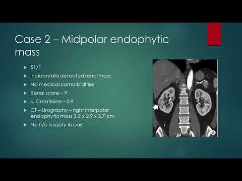 Robotic approach for complete endophytic tumors