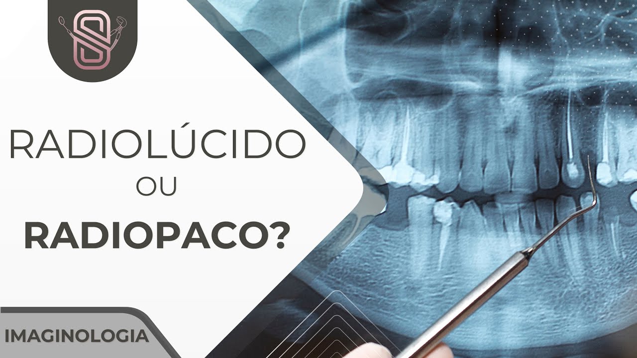 Radiografia odontológica - Imaginologia (Aula 01)