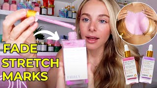 Products You NEED To Prevent Stretch Marks and Boobne!