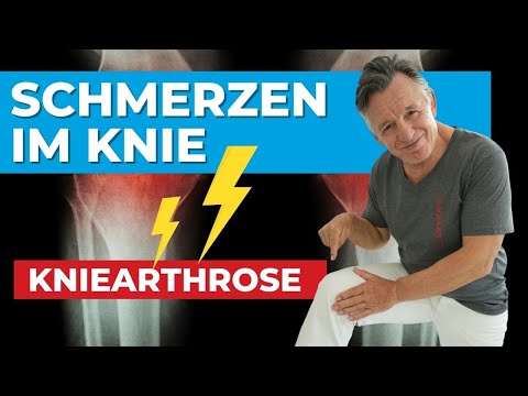 Du hast Schmerzen im Knie? Kniearthrose ⚠️ Keine Angst - So hilfst du dir!🍀