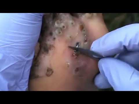 download lagu mp3 mp4 Bicho De Pe, download lagu Bicho De Pe gratis, unduh video klip Bicho De Pe