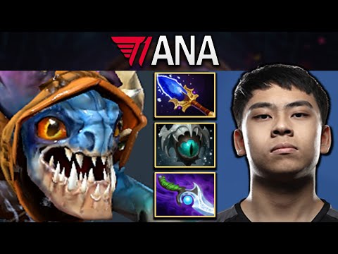 Slark Dota 2 Gameplay T1.Ana with Diffusal and Eye of Skadi