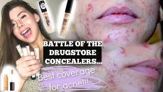 THE BEST ACNE COVERAGE CONCEALER IN THE DRUGSTORE 