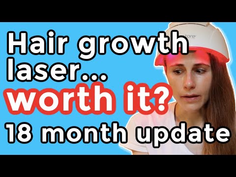 iRestore hair growth laser 18 month update. Is it worth it?| Dr Dray