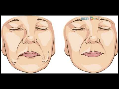 Mulher.com - 30/01/2017 - Envelhecimento - Dr. Rodrigo Credidio