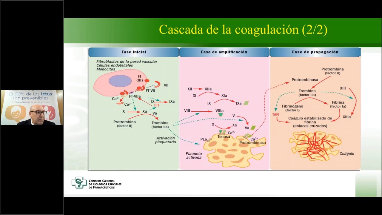 Ictus. Aspectos diferenciales Anticoagulantes Orales. Santiago Cuéllar