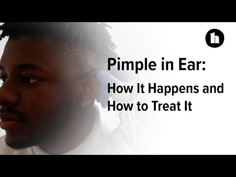 What Causes Pimples In Ear