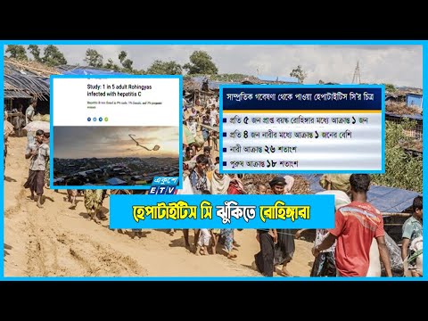 প্রতি ৫ জন প্রাপ্ত বয়স্ক রোহিঙ্গাদের মধ্যে ১ জন হেপাটাইটিস সি’তে আক্রান্ত