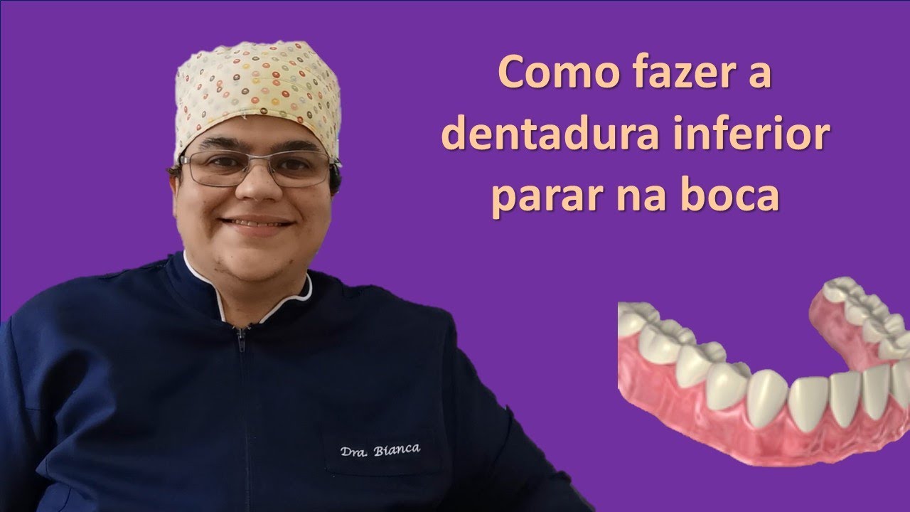 Como fazer a dentadura inferior parar na boca? | Dra Bianca Rosa