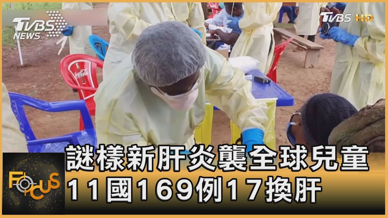 謎樣新肝炎襲全球兒童 11國169例中17換肝