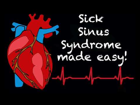 EMS Cardiology || Tachy Tuesday: Sick Sinus Syndrome in EMS