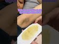 Bạn từng mắc sai lầm nào wax không ra lông chưa???