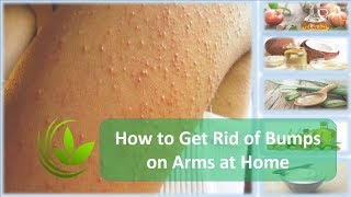 How to Get Rid of Bumps on Arms at Home