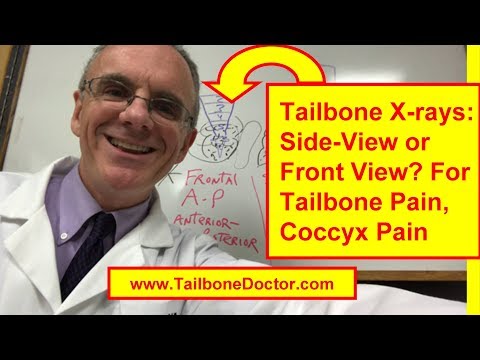 Coccyx X-rays: Side-view vs Front-view, for Tailbone Pain, Coccyx Pain