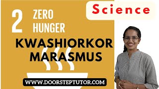 Pediatrics Difference between marasmus and Kwashiorkor PEM Protein energy  malnutrition Age Growth  YouTube