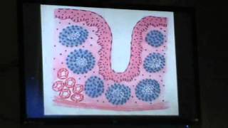 30) Dr.Gihan 03/05/2014 [Spleen - Thymus - Tonsil]