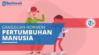 Achondroplasia, Gangguan Pertumbuhan Tulang Termasuk Dwarfisme atau Tubuh Kerdil