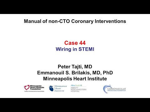 Case 44: PCI Manual - Wiring in STEMI