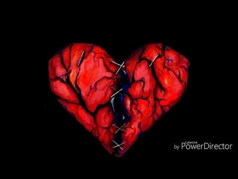 OTK Tristan-Watch me die slowly