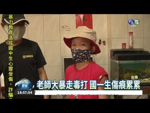 玩同學鞋子被體罰 國一生渾身傷