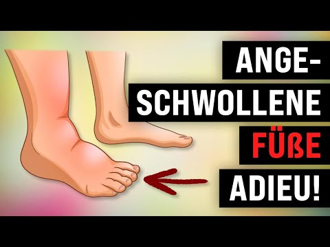 6 Wege, um geschwollene Füße und Knöchel zu verkleinern (Hausmittel)