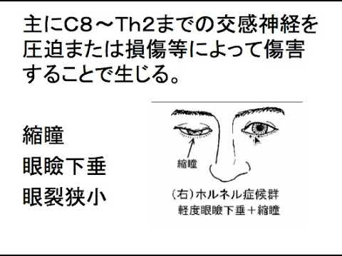 犬のホルネル症候群:症状と治療法