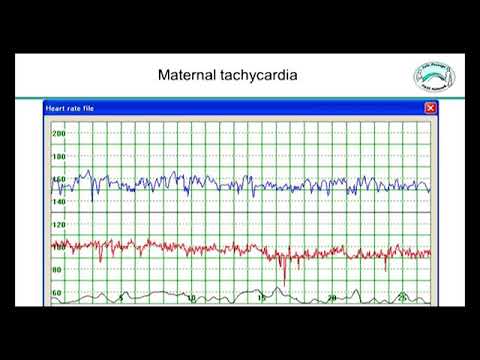 Maternal heart rate and heart rate varaibility during pregnancy