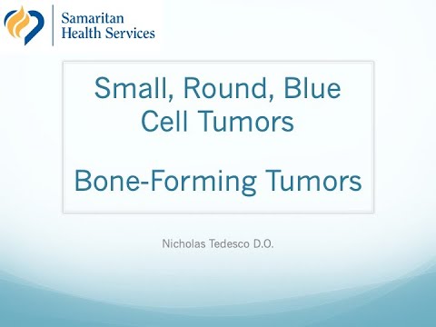Tedesco -  Bone & Blue Tumors