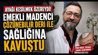 Ayağı Kesilmek Üzere Olan Emekli Madenci, Çözünebilir Deri İle Sağlığına Kavuştu