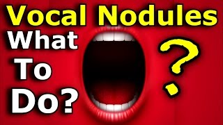 Vocal Nodules - Nodes - Polyps - What To Do - Ken Tamplin Vocal Academy