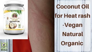 Coconut Oil for Heat Rash - Remedy - Vegan DIY Natural & Organic