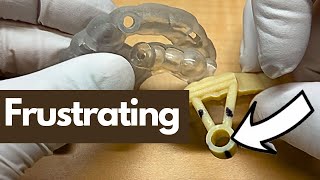 Prevent these PROBLEMS before 3D printing ENDO guides.