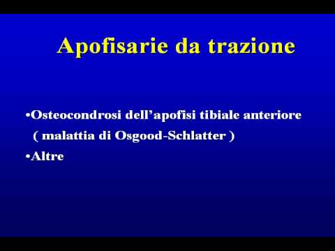 Dolore durante il movimento nella parte bassa della schiena durante la gravidanza Fisioterapia con artrosi dellarticolazione della caviglia