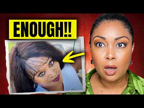 Who told y'all this baby hair trend was cute?