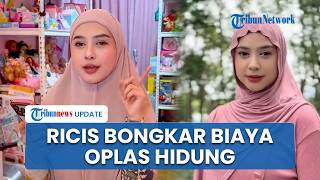 Ria Ricis Ungkap Biaya Oplas Hidung Capai Ratusan Juta, Akui Ada Masalah Kesehatan Menahun