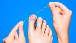 I had Ingrown Toenails Often, Then I Used These Tricks And My Feet look Fabulous