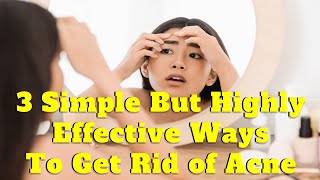 3 Simple But Highly Effective Ways to Get Rid of Acne