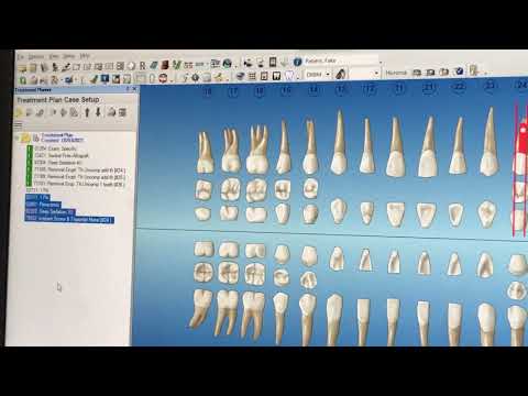How to Create a Treatment Plan in Dentrix