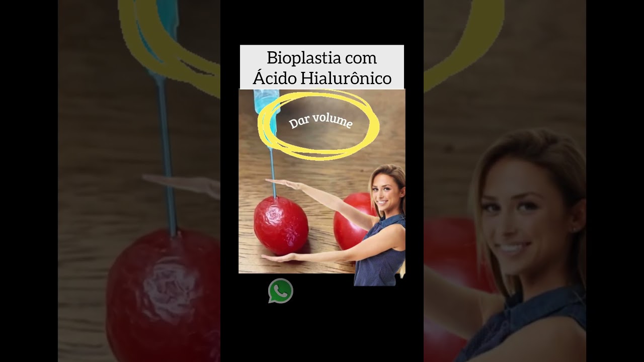 Leonardo De Souza Alves-117