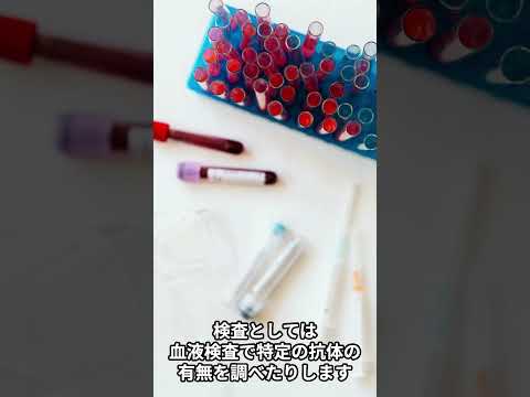 狼瘡 – それは何か、症状、診断、治療およびケア