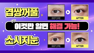 겹쌍꺼풀 & 소시지눈 '이것' 알면 해결 가능